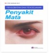 Image of Pengobatan dan Pencegahan Penyakit Mata